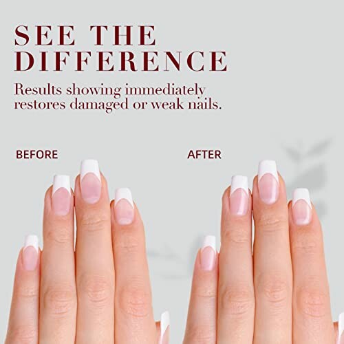 Comparison of nails before and after treatment.